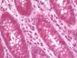 DNM1L / DRP1 Antibody (Internal)